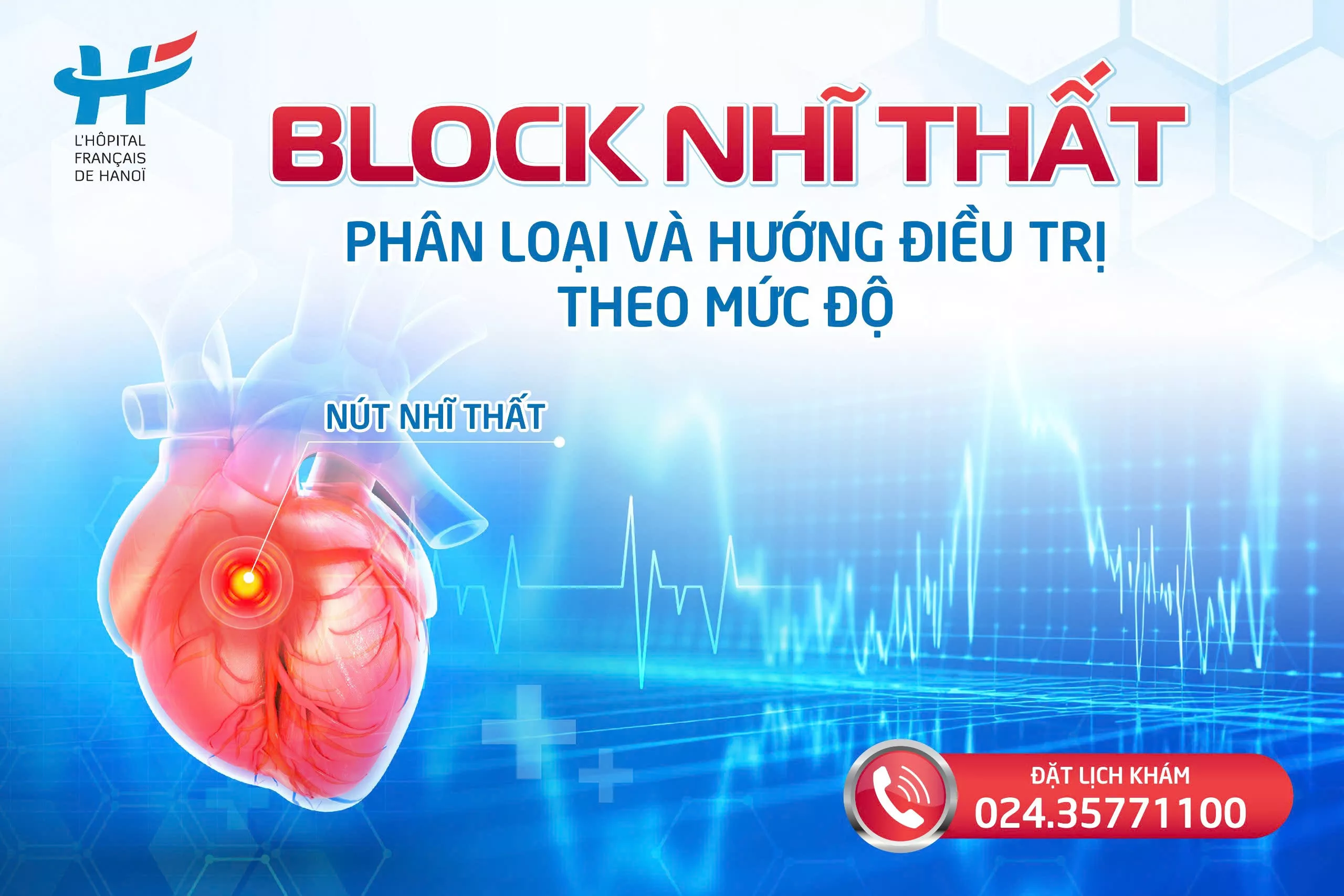 Atrioventricular Block: Categorization and Treatment